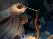 eel, anus,