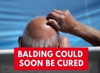 New hair loss treatment could cure balding