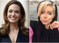 Iranian woman undergoes 50 surgeries to look like Angelina Jolie