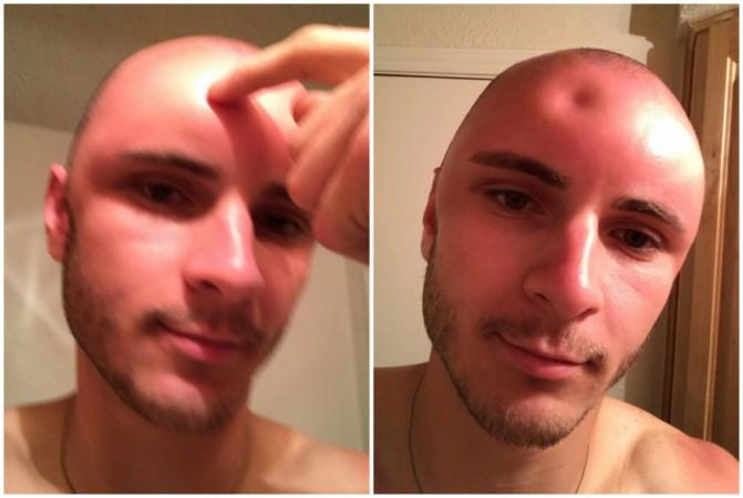 Cade Huckabay posted on Twitter saying, dent in head