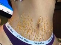 Stretchmarks