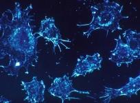 cancer cells