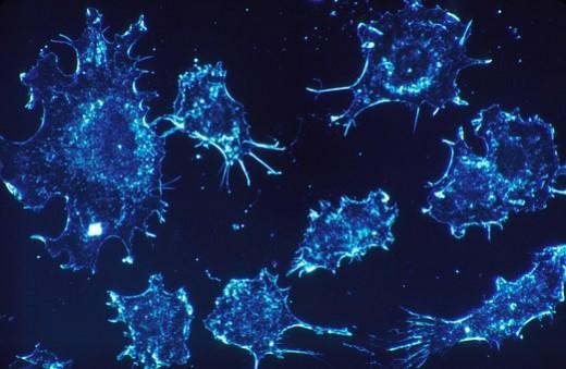 Representational Image cancer cells