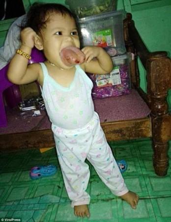 Zhyrille Cruz rare codition,
