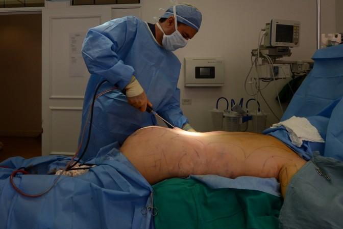 Butt implant treatment in India