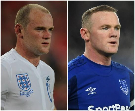 Wayne Rooney before hair transplant (L). Rooney post hair transplant. (R) wayne rooney hair transplant