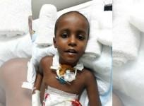 Brain Tuberculoma