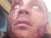 Oscar Perez broadcasts shoot out with Venezuelan police on Instagram
