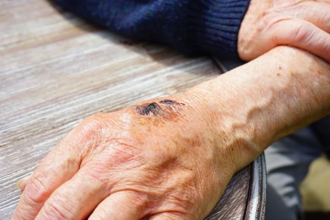 Representational Image wound