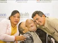 Teenage boy dies after surgery to remove giant tumor from face