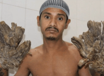 tree man