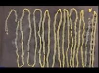 tapeworm, giant tapeworm,