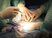surgery