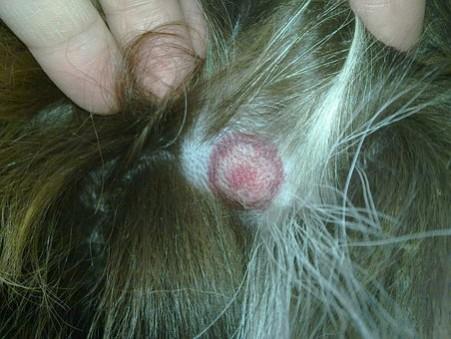 Erythema migrans- rash from Lyme disease Rash from lyme disease