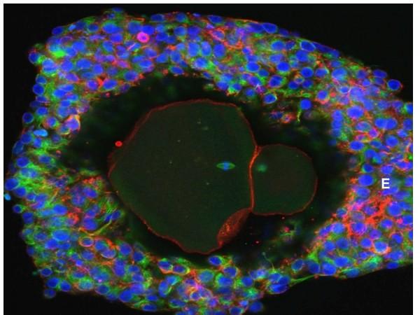 An undated picture shows a magnification of a lab-grown fully matured human egg ready for fertilization. Magnification of a lab-grown fully matured human egg