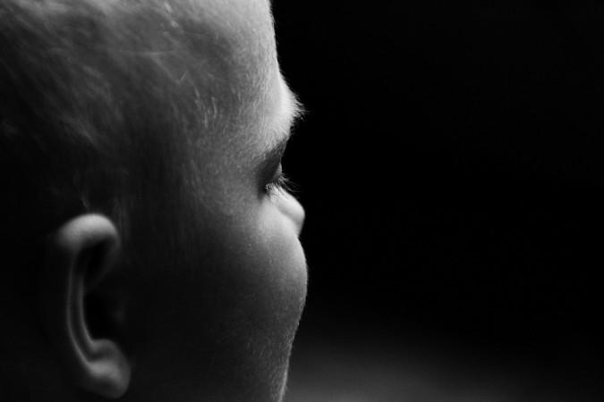 Representational Image ears