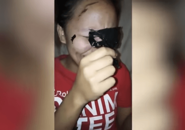 Genella Pabianes Carabbacan, from Isabela in the Philippines, struggles to take off the mask made up of two packets of the sticky mixture – before it eventually rips out her eyebrows. woman rips off eyebrows trying to peel off charcoal mask