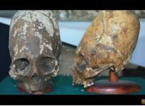 Paracas skulls,