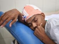 Santlal Pal, 31, rests in his bed as he recuperates at the BYL Nair hospital in Mumbai on February 22, 2018. Indian surgeons who removed a massive brain tumour in a marathon seven-hour procedure said on February 22 it could be the heaviest ever recorded.