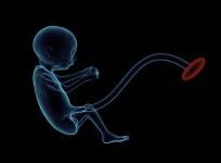 Foetus