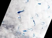Melt lakes