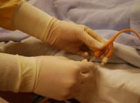 catheter