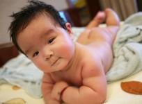 Chinese baby born with three legs has third limb removed in a 10 hour long surgery.