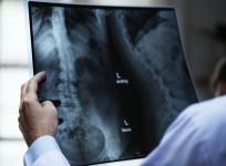 x ray