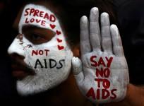 HIV/AIDS