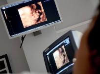 ultrasound