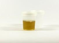 Urine test