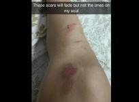 Indore model suffers accident after men sexually harassed her