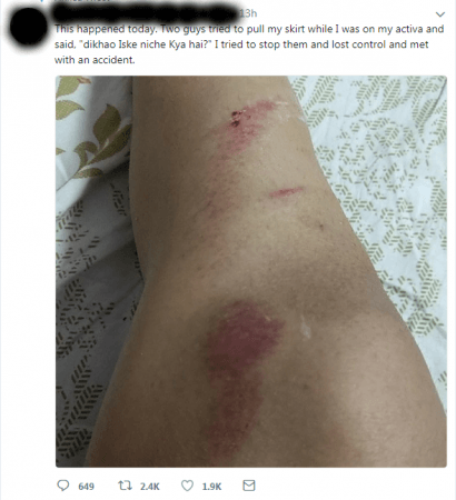 Indore model suffers accident after men sexually harassed her Indore model suffers accident after men sexually harassed her