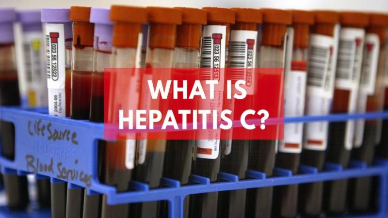 What Is Hepatitis C?