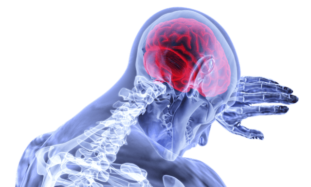 Picture for representation brain