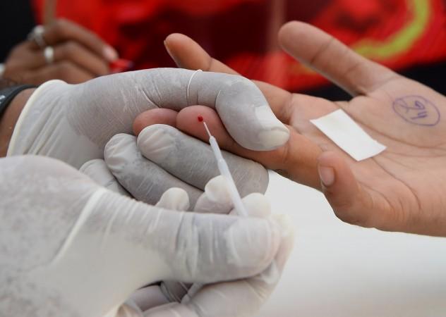 According to researchers, the virus may cause inflammation of blood vessels, which puts pressure on the cardiovascular system. HIV Aids