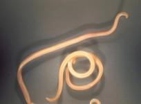 Roundworm