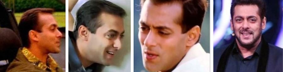 Why did Salman Khan have 3 Hair Transplants