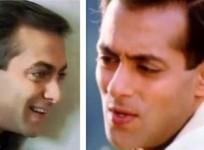 Salman hair transplant