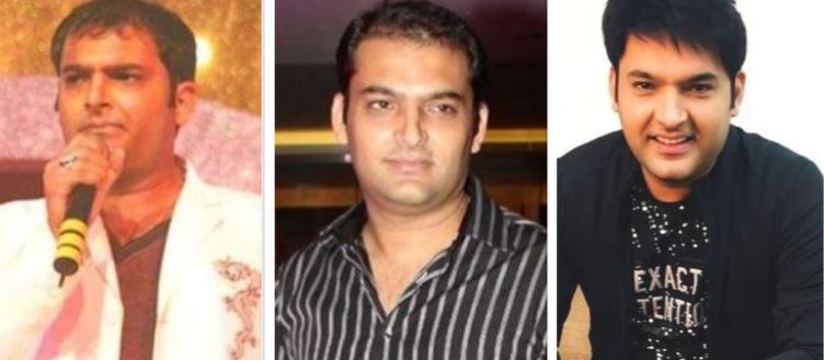 Kapil Sharma hair transplant