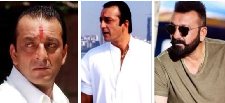 Sanjay Dutt hair transplant