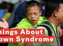 5 Things To Know About Down Syndrome