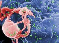 Human Immuno Virus