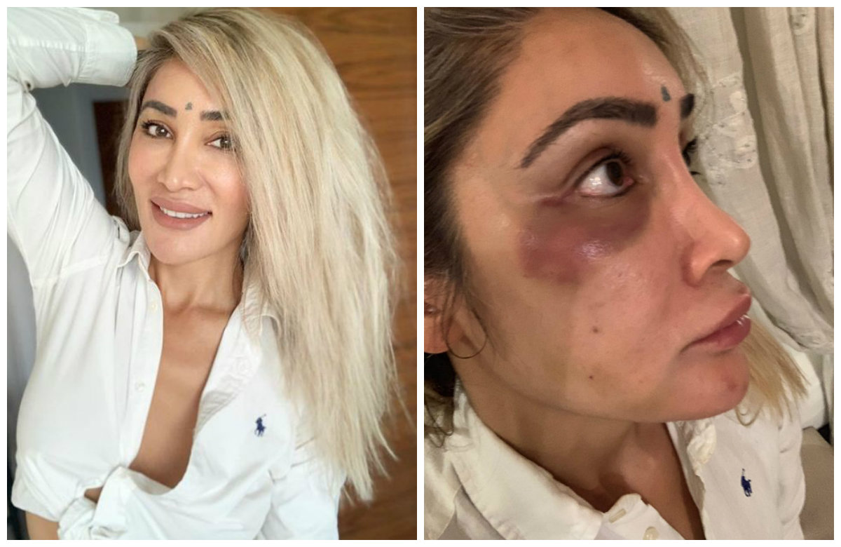 Academia locutor Inodoro Exclusive: Ex Bigg Boss contestant Sofia Hayat physically assaulted in  London; details inside - IBTimes India