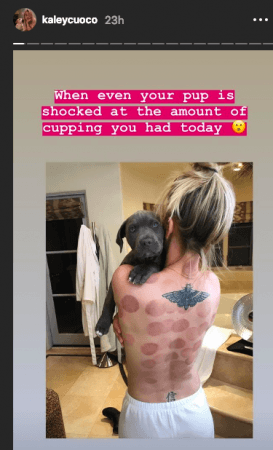 Big Bang Theory S Kaley Cuoco Shares Painful Backless Photo On Instagram Ibtimes India After a series of supporting film and television roles in the late 1990s. big bang theory s kaley cuoco shares