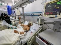 Yemeni boy lies in a hospital bed