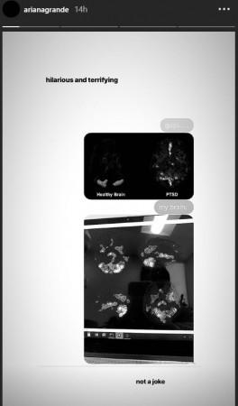 Ariana Grande shares a picture of her brain scan on her Instagram Story Ariana Grande