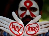 AIDS/HIV