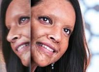 Deepika Padukone film Chhapaak first look