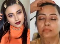 Shaifali Nagpal and acid attack survivor
